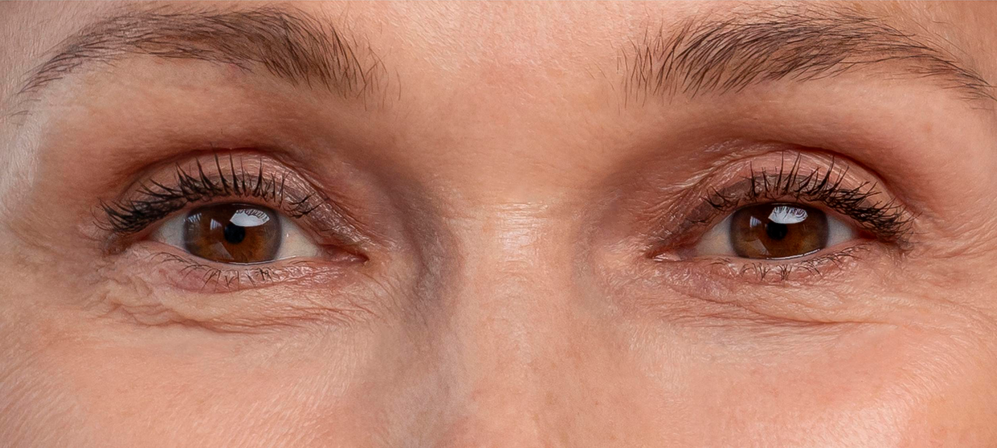 antiaging-beauty-treatment 1