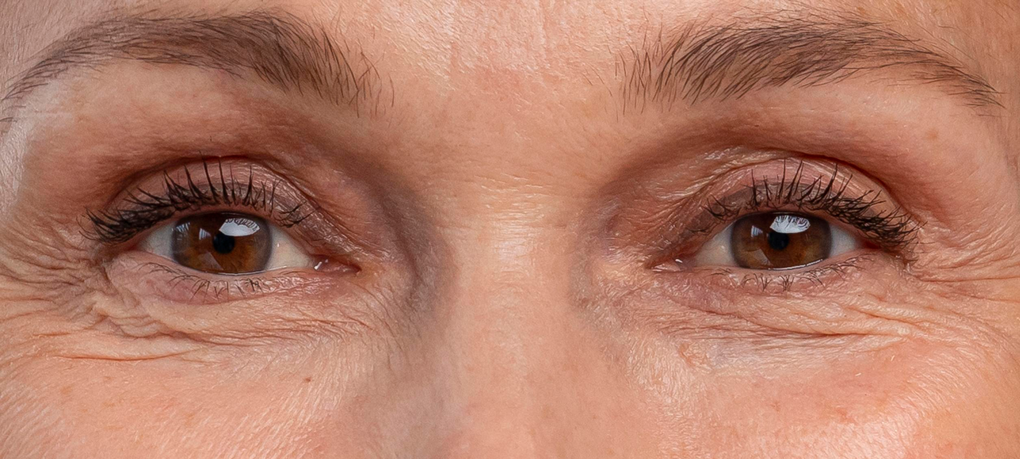 antiaging-beauty-treatment 2